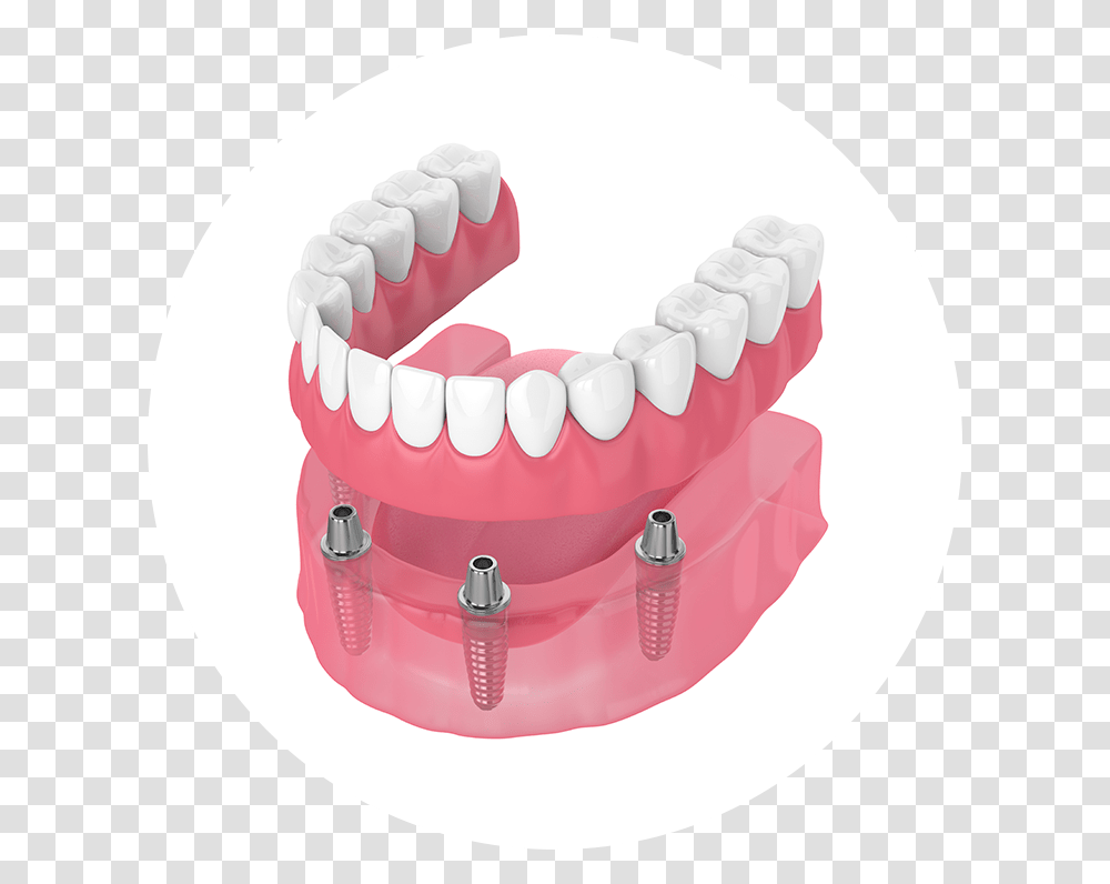 Dentures, Jaw, Teeth, Mouth, Lip Transparent Png
