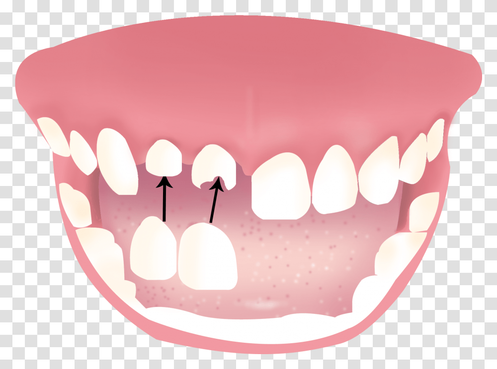 Dentures, Teeth, Mouth, Lip, Birthday Cake Transparent Png