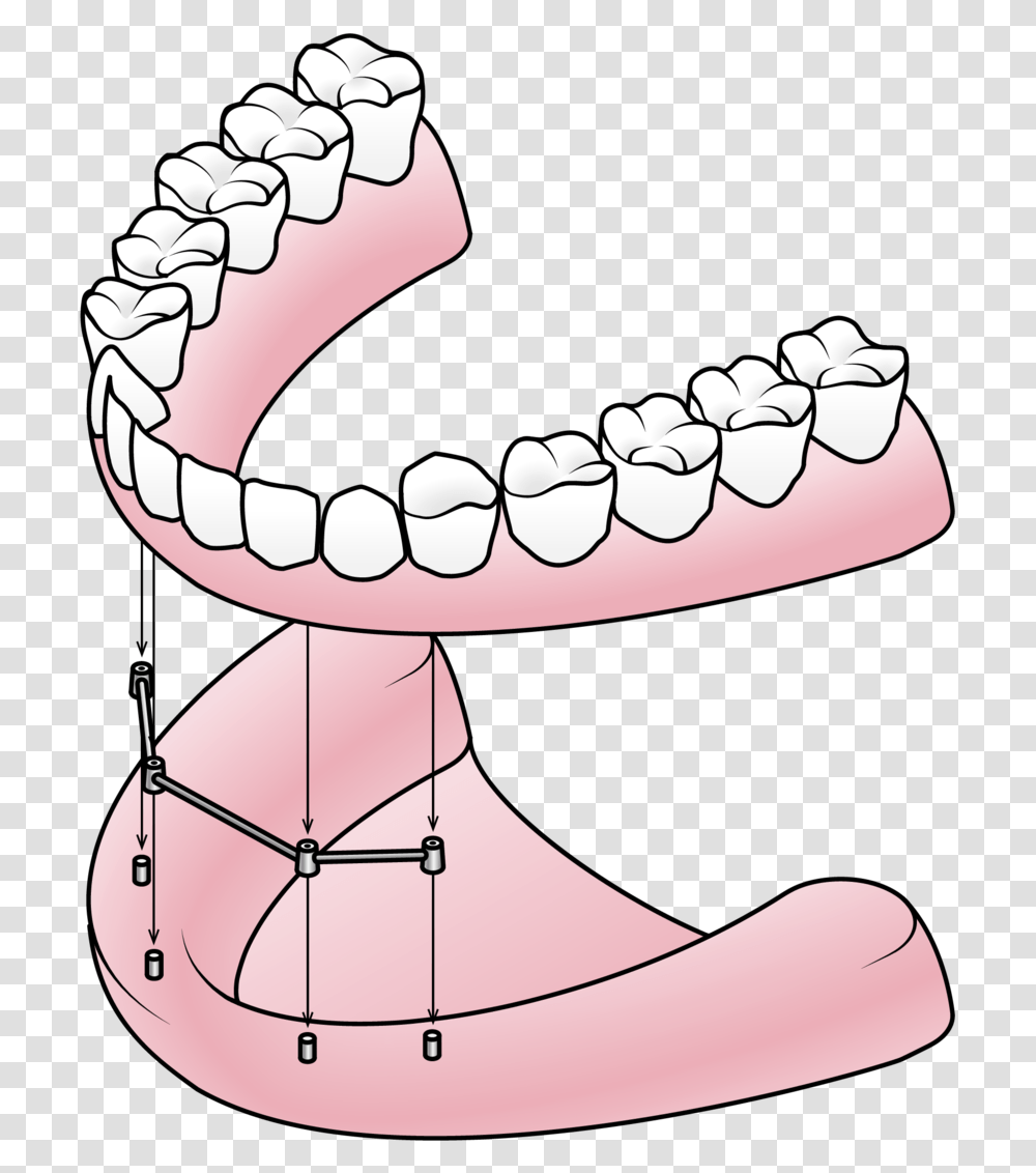 Dentures Valley Dental Components Of A Denture, Teeth, Mouth, Lip, Jaw Transparent Png