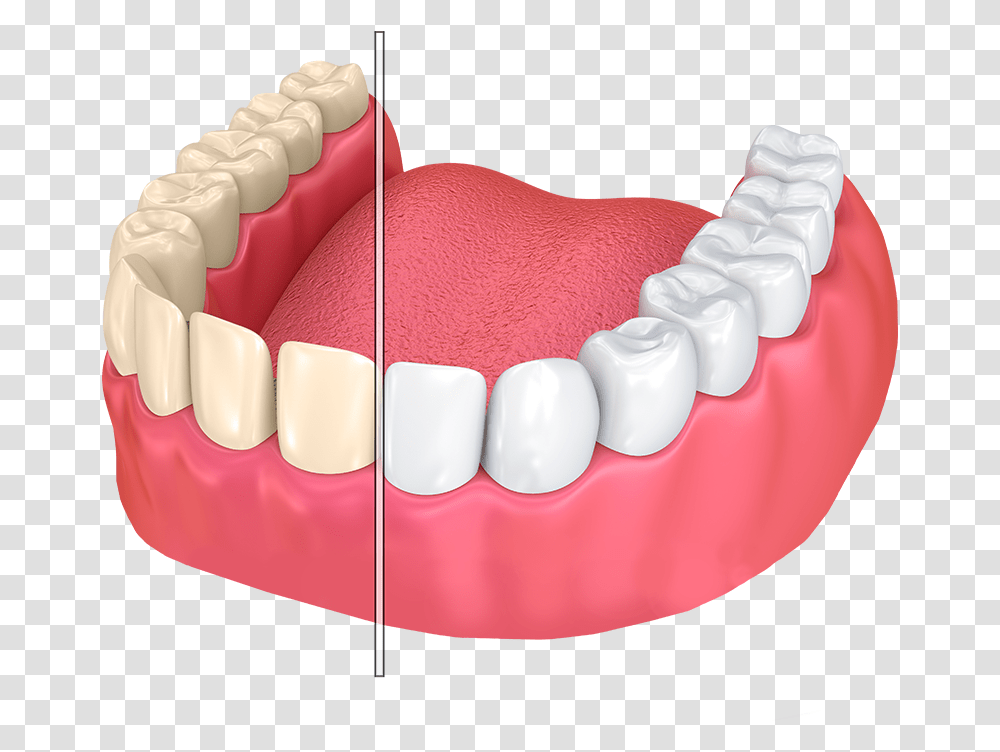Dentures Whitening Teeth, Mouth, Lip, Jaw, Birthday Cake Transparent Png