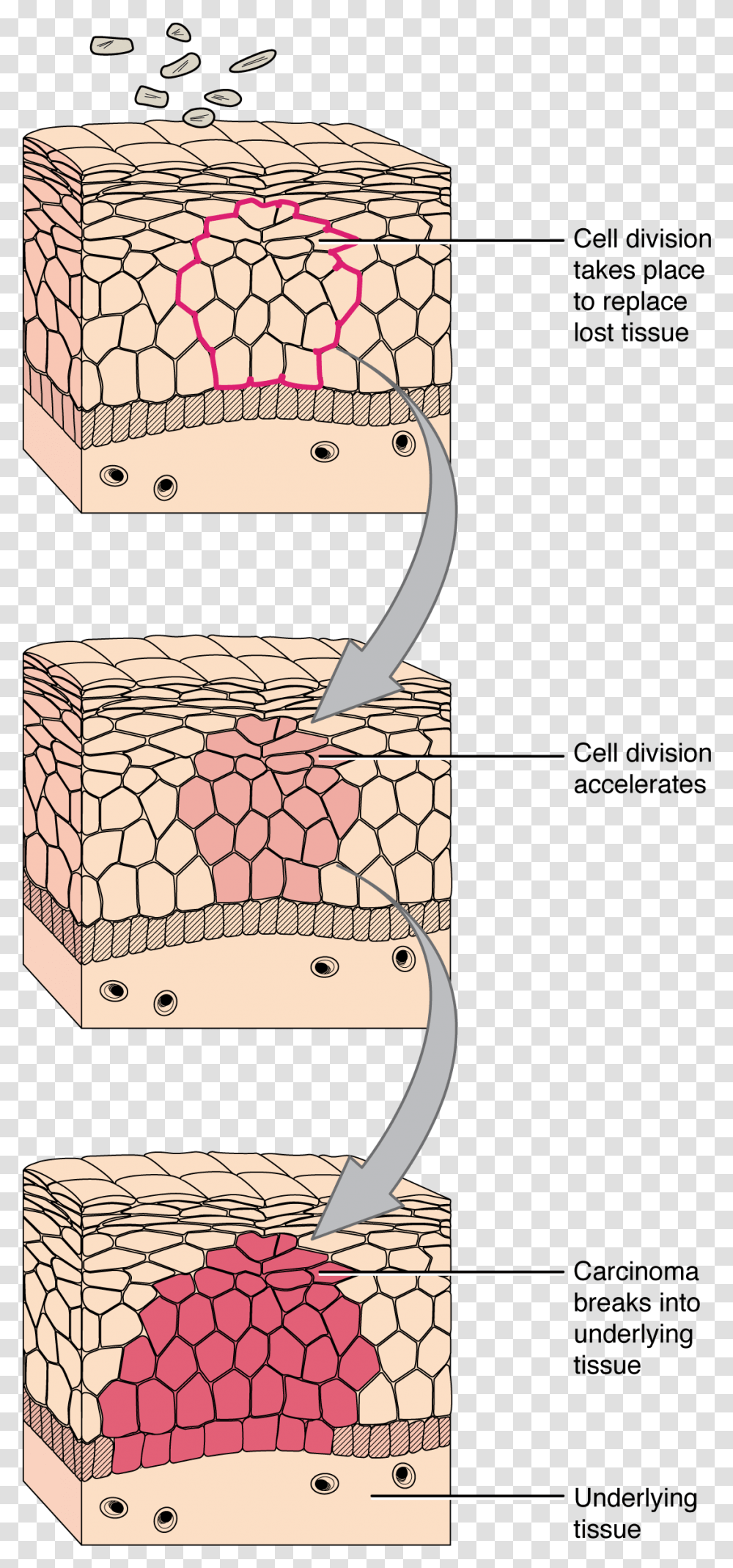 Development Of Cancer Tissue And A Cell Diagram, Handbag, Accessories, Accessory, Purse Transparent Png