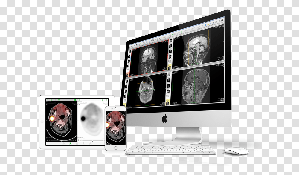 Devices Osirix Pacs Server, Pc, Computer, Electronics, Computer Keyboard Transparent Png