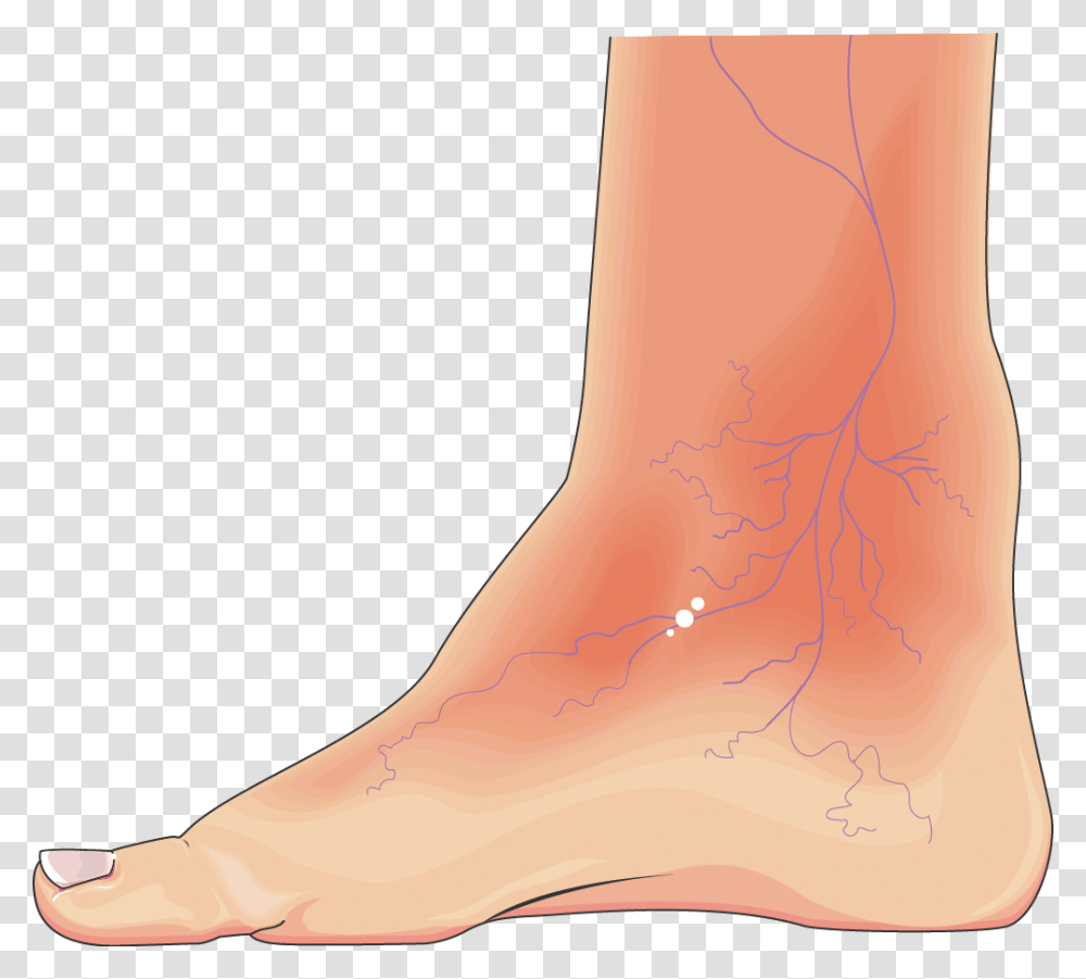 Diabatic Foot, Ankle, Heel, Toe, Skin Transparent Png