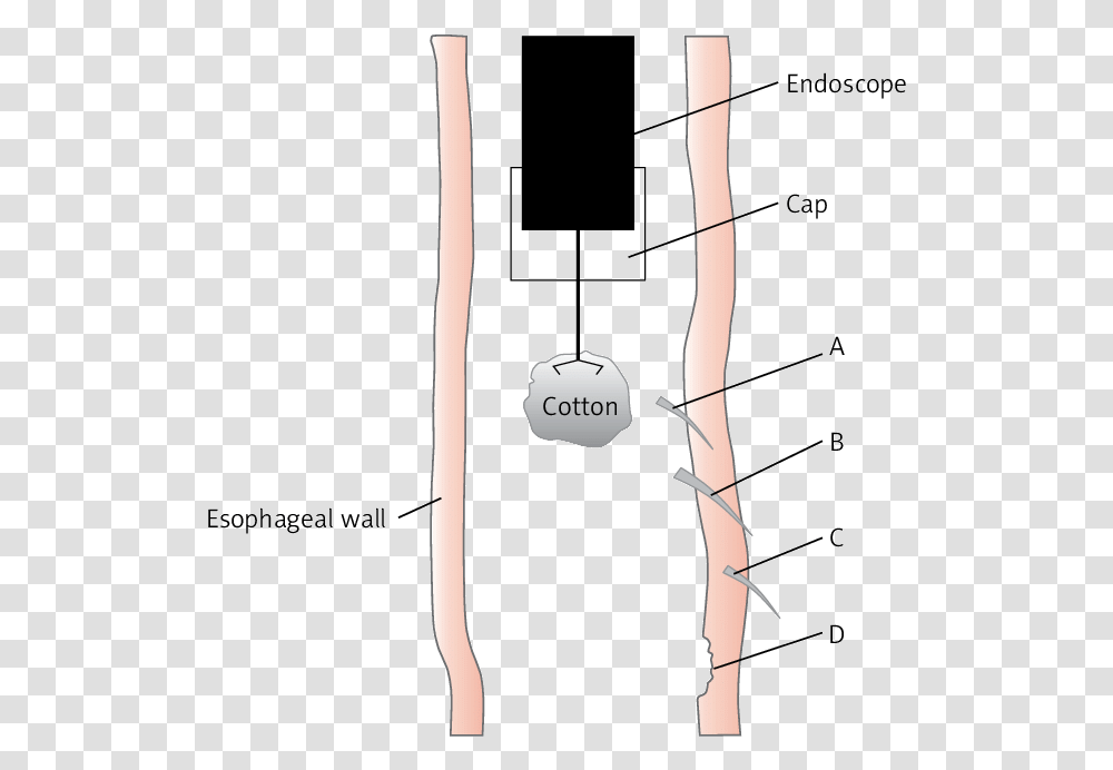 Diagram, Bow, Electronics, Utility Pole, Ipod Transparent Png