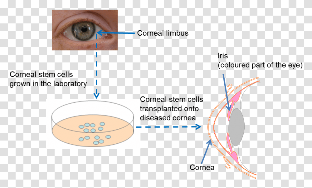 Diagram On Repairing The Cornea Holoclar Stem Cell, Pattern, Person, Human, Contact Lens Transparent Png