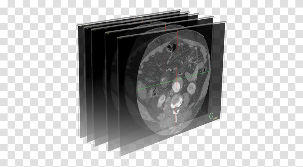 Dicom Image Icon, X-Ray, Ct Scan, Medical Imaging X-Ray Film Transparent Png