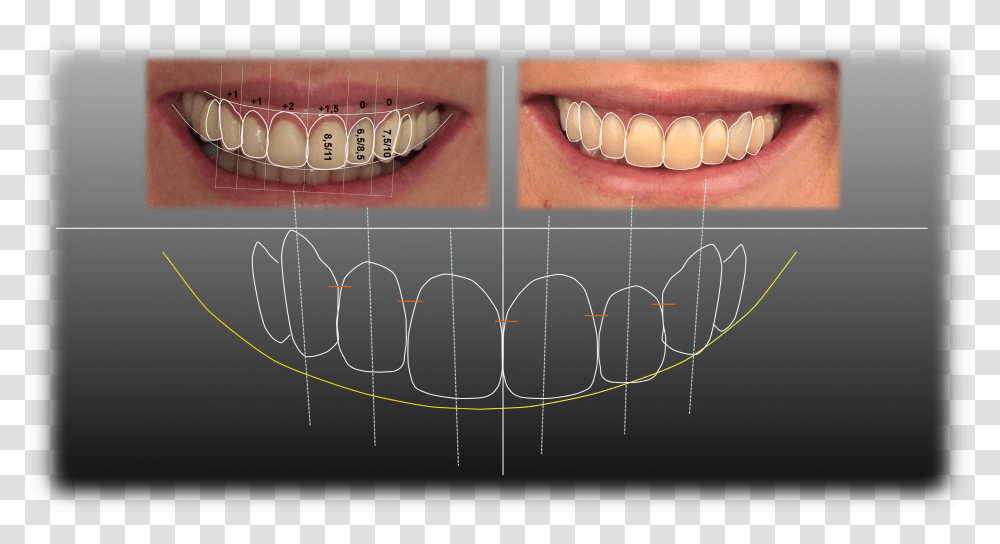 Digital De Sonrisa, Teeth, Mouth, Lip, Jaw Transparent Png