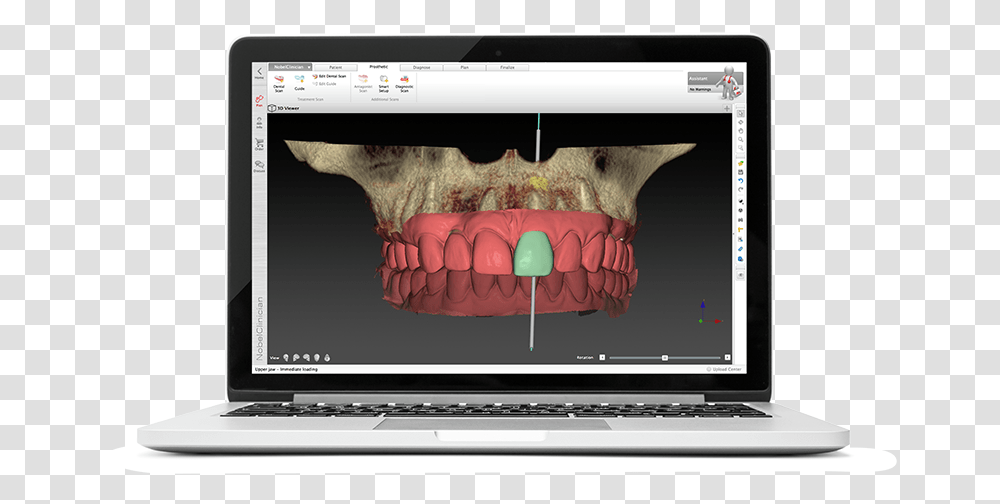 Digital Dentistry Workflow Courses Netbook, Laptop, Pc, Computer, Electronics Transparent Png