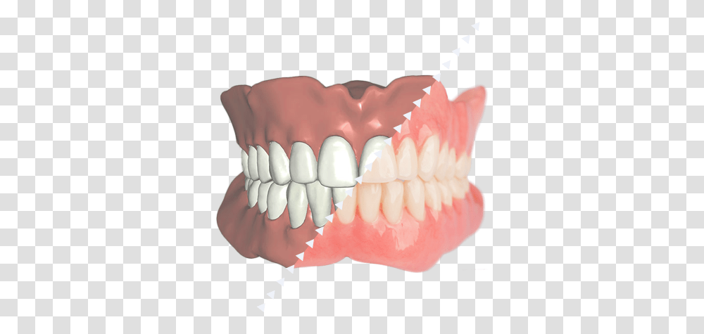 Digital Denture Jaw, Teeth, Mouth, Lip, Birthday Cake Transparent Png