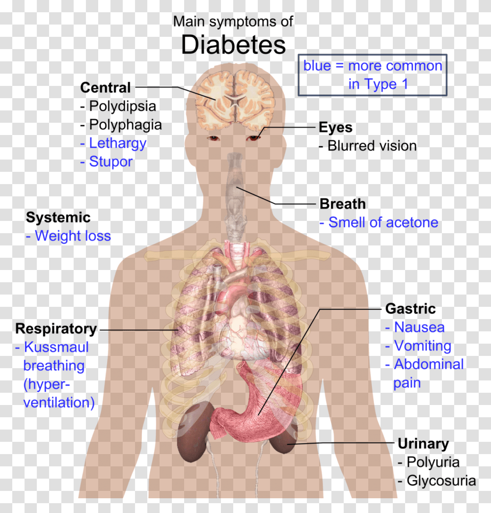 Disease In Organ System, Diagram, Neck, Plot, Person Transparent Png