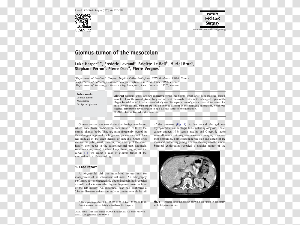 Document, X-Ray, Medical Imaging X-Ray Film, Ct Scan Transparent Png