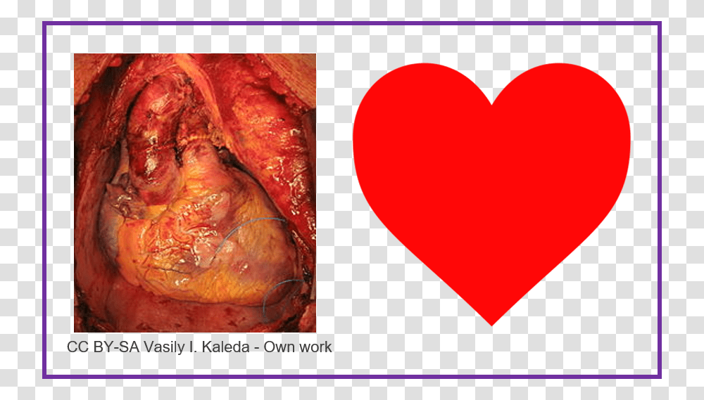 Does A Heart Look Like, Painting, Food Transparent Png