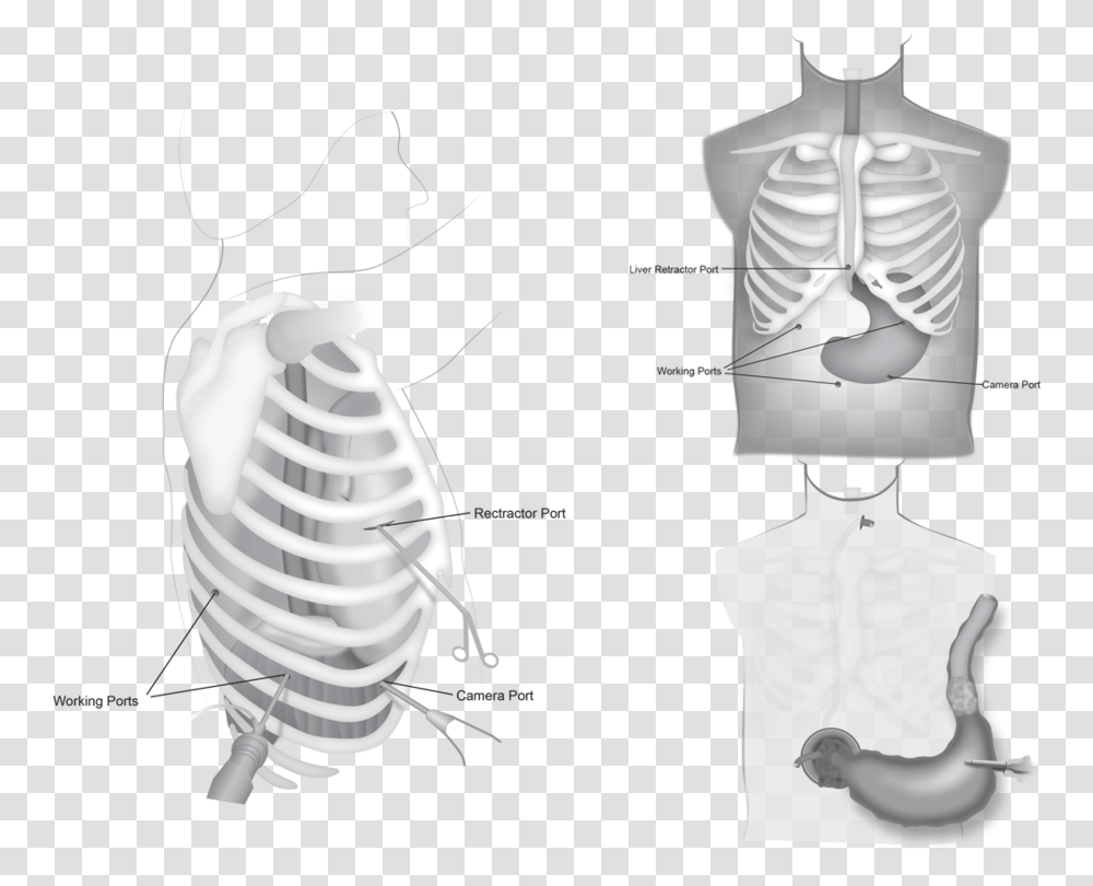 Download Stomach Rib, Torso, Hip, X-Ray, Medical Imaging X-Ray Film Transparent Png