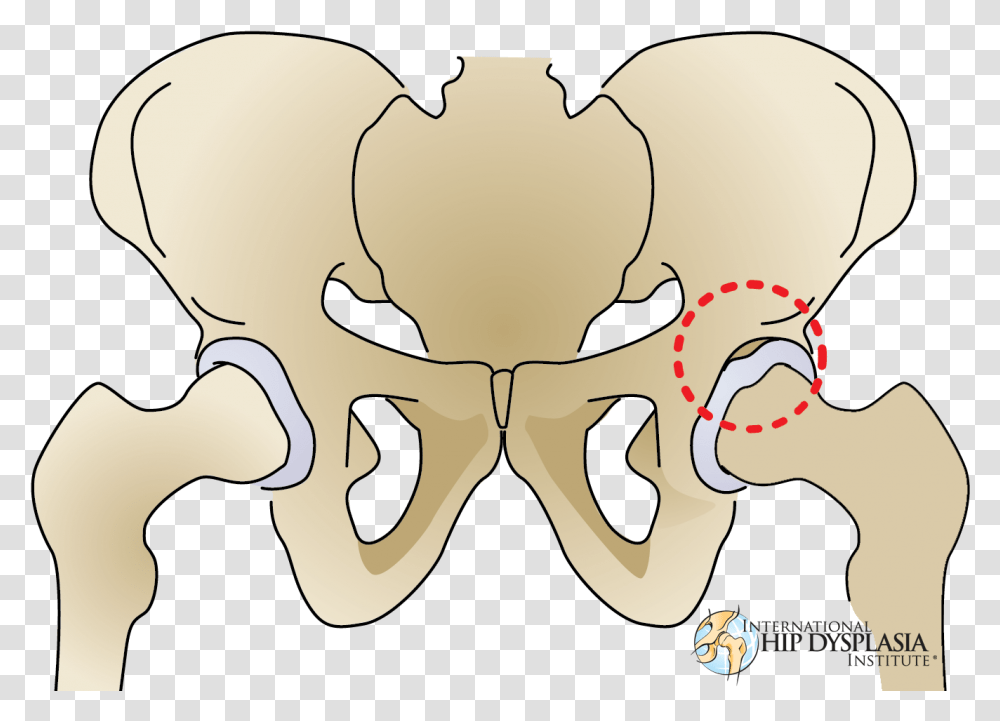 Dysplasia Labrum, Hip, Jaw, Head Transparent Png