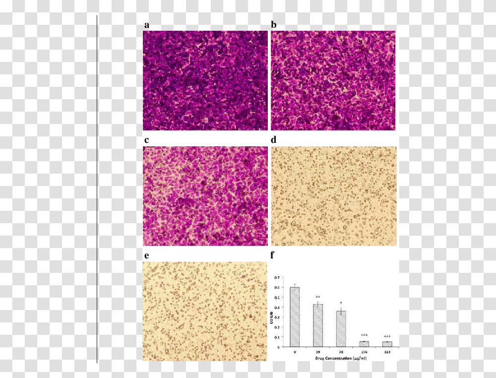Effect Of Oridonin On Huvec Migration Glitter, Purple, Rug, Stain, Cork Transparent Png