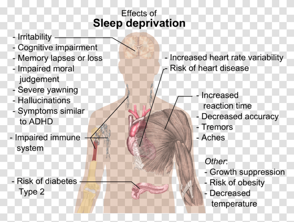 Effect Of Sleep Deprivation Effects Of Sleep Deprivation, Person, Human, Plot, Neck Transparent Png