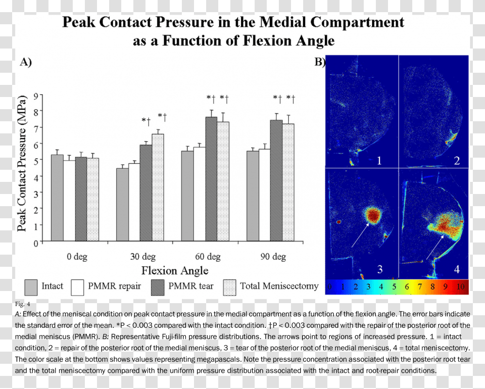 Effect Of The Meniscal Condition Pressure On Meniscus, Nature, Outdoors, Plot Transparent Png