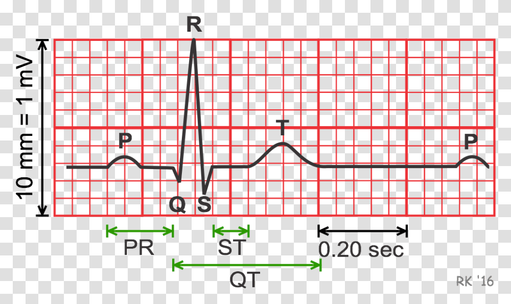 Electrocardiogram Durations And Intervals Ecg Duration, Electronics, Back, Monitor Transparent Png
