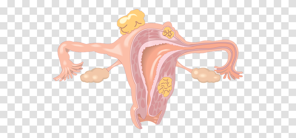 Endometriosis And Fibroids With Connection To Co Dependancy Baby In The Uterus, Ear, Animal, Stomach Transparent Png