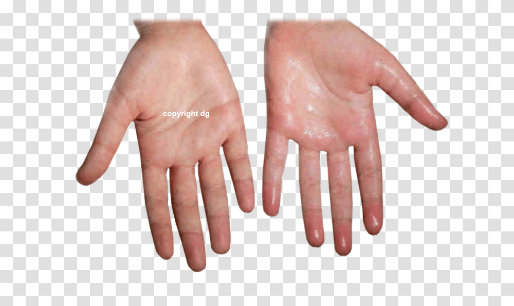 Excessive Sweating Body Jewelry, Hand, Wrist, Person, Human Transparent Png