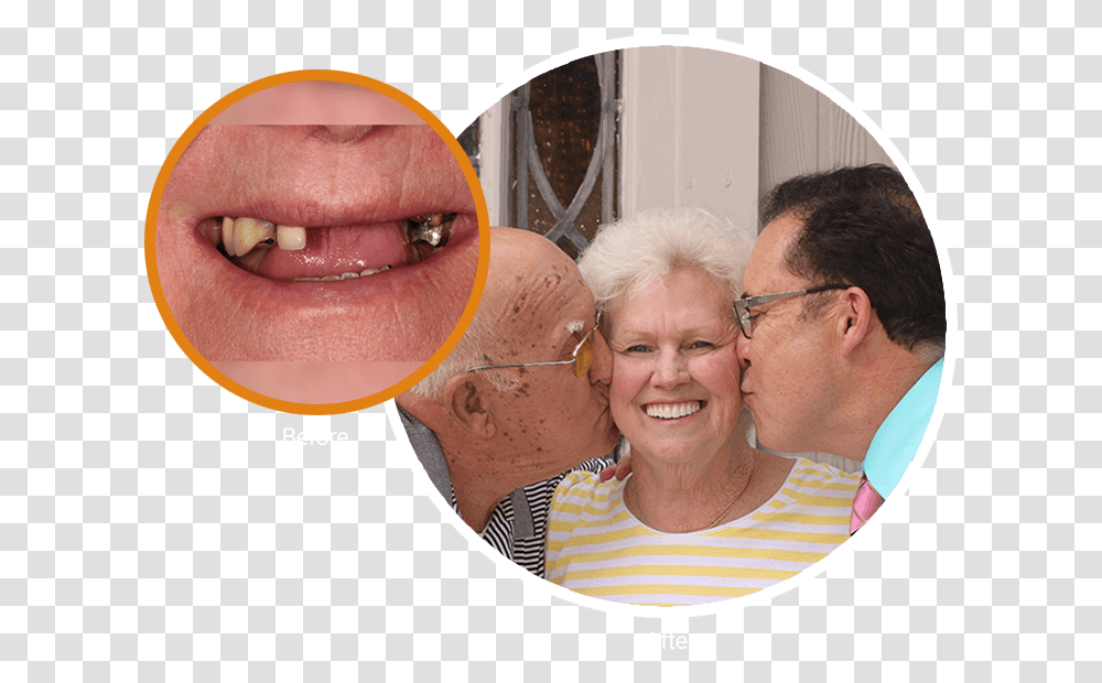 Extreme Close Up Of Sue S Smile And Then Next To It Fun, Person, Human, Mouth, Lip Transparent Png