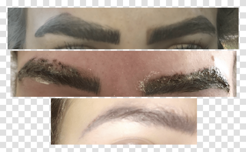 Eyebrow Tattoo Removal Process, Face, Person, Human, Skin Transparent Png