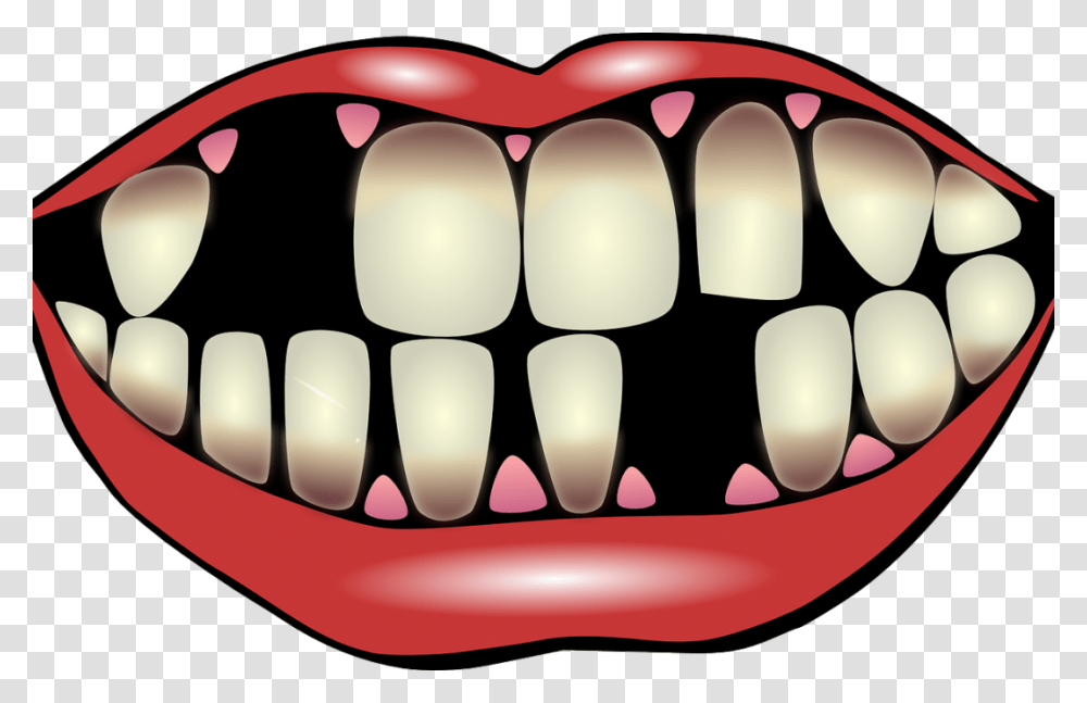 Factors For Losing Your Teeth Port Pediatric Dentistry, Mouth, Lip, Jaw Transparent Png
