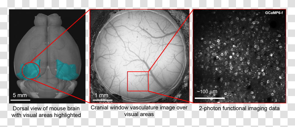 File Surgery Visual Cortex Mouse Brain Cranial, Sphere, X-Ray, Medical Imaging X-Ray Film, Ct Scan Transparent Png