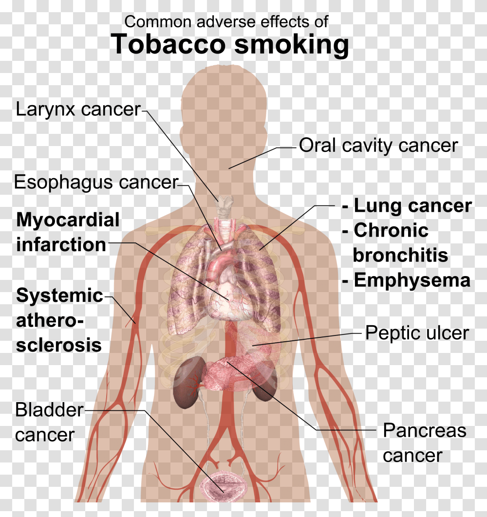 Fileadverse Effects Of Tobacco Smokingpng Wikimedia Commons Physical Effects Of Smoking, Person, Human, Back, Plot Transparent Png