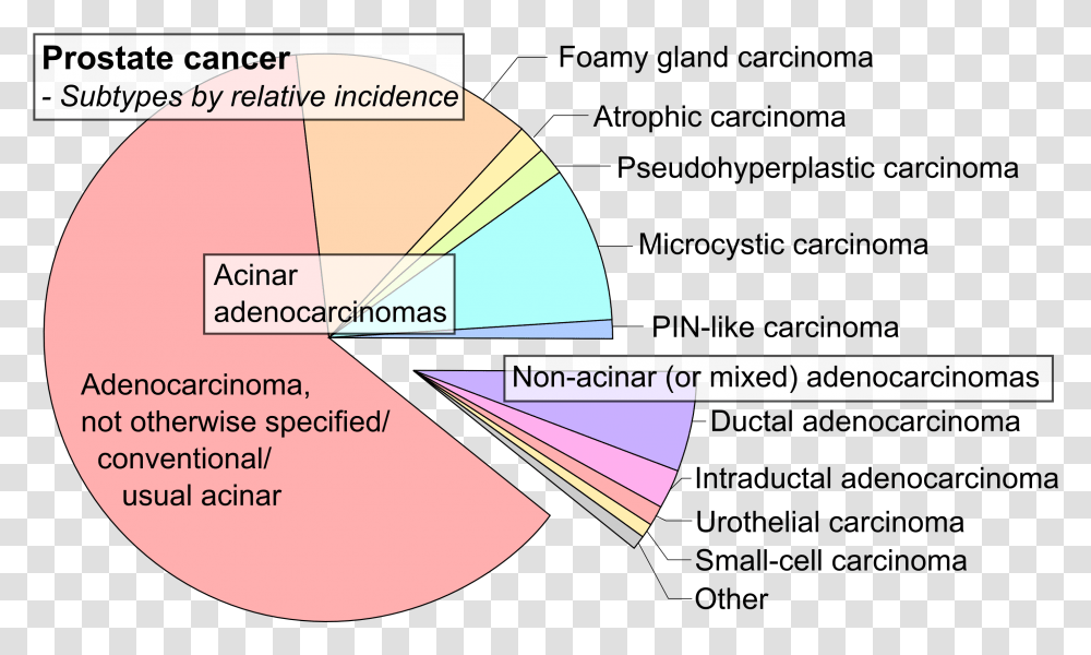 Fileprostate Cancer Typespng Wikipedia Prostate Cancer Types, Plot, Diagram, Text, Business Card Transparent Png