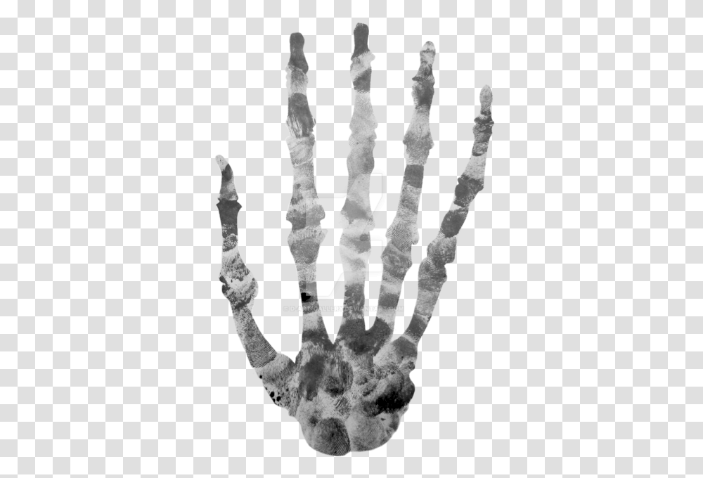 Finger Printed Skeleton By Skeleton Hands In Head, X-Ray, Medical Imaging X-Ray Film, Ct Scan, Chess Transparent Png