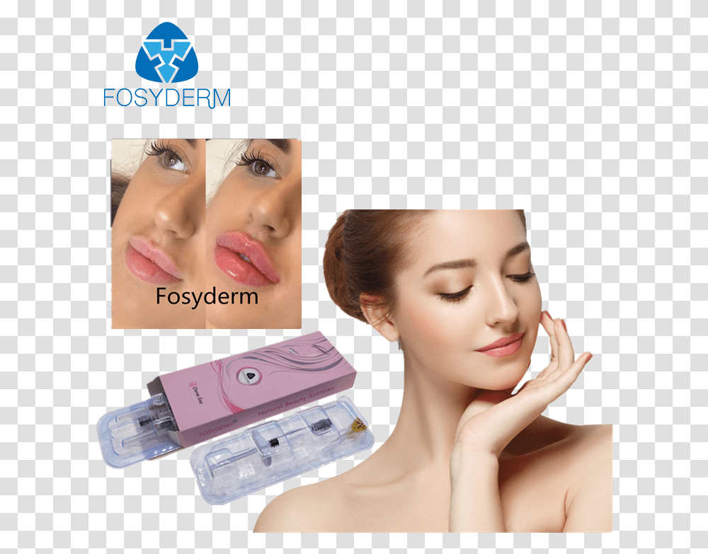 Fosyderm 2ml Derm Lines Injectable Dermal Filler For Lips Facial Cantik, Person, Human, Face, Head Transparent Png