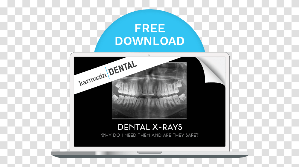 Free Download Of Karmazin Dental S Ebook Led Backlit Lcd Display, X-Ray, Ct Scan, Medical Imaging X-Ray Film Transparent Png