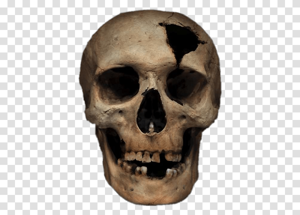 Freetoedit Skull Cracked Stickerart Blunt Force Trauma Skeleton, Head, Jaw, Teeth, Mouth Transparent Png