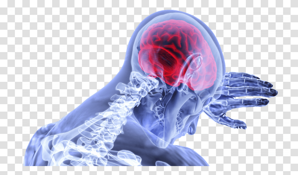 Graphic Showing Brain And Skeleton, X-Ray, Medical Imaging X-Ray Film, Ct Scan, Person Transparent Png