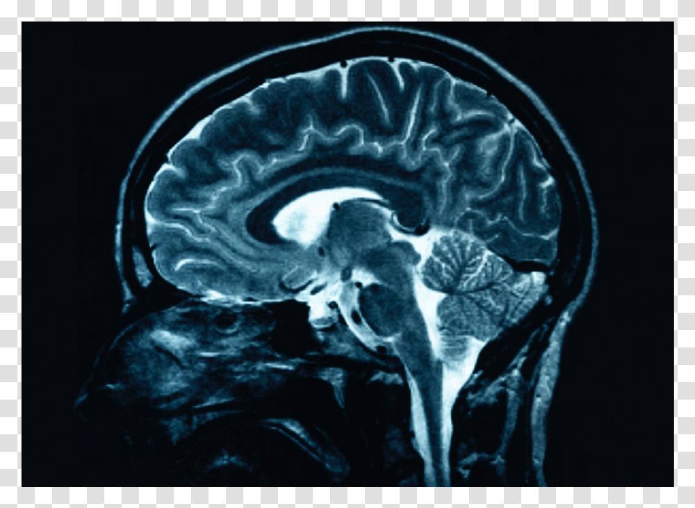Greys Anatomy Brain Scans, X-Ray, Medical Imaging X-Ray Film, Ct Scan, Painting Transparent Png