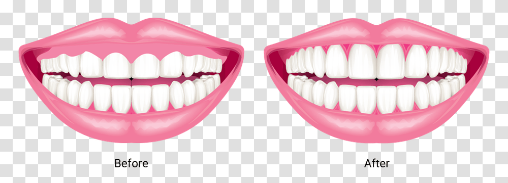 Gum Drawing Front Tooth Gums, Teeth, Mouth, Lip, Jaw Transparent Png