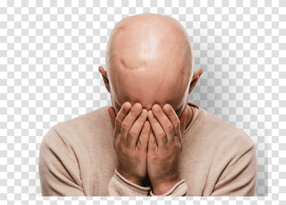 Hair Loss, Head, Person, Human, Face Transparent Png