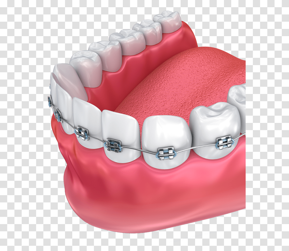 Haltom Orthodontics Tooth Orthodontics, Jaw, Teeth, Mouth, Lip Transparent Png