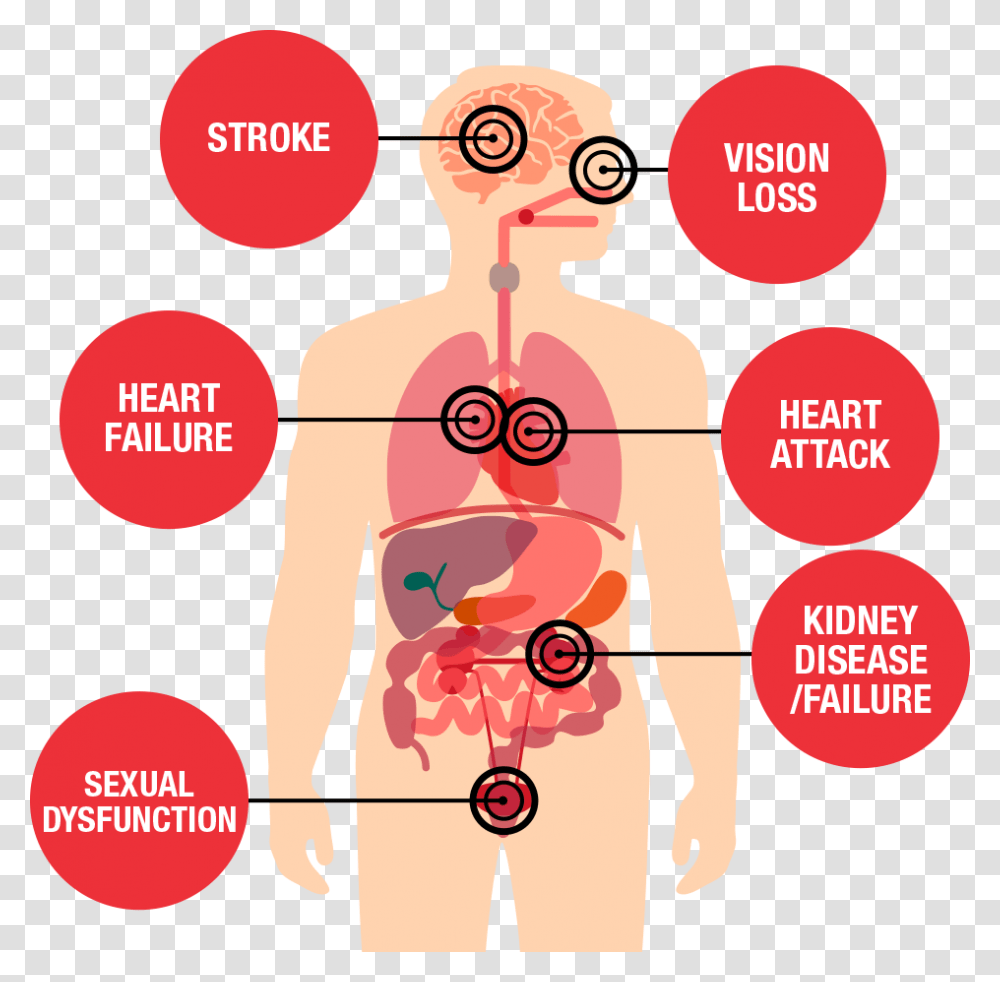 Health Threats Diagram Effects Of High Blood Pressure, Plot, Poster, Advertisement, Paper Transparent Png