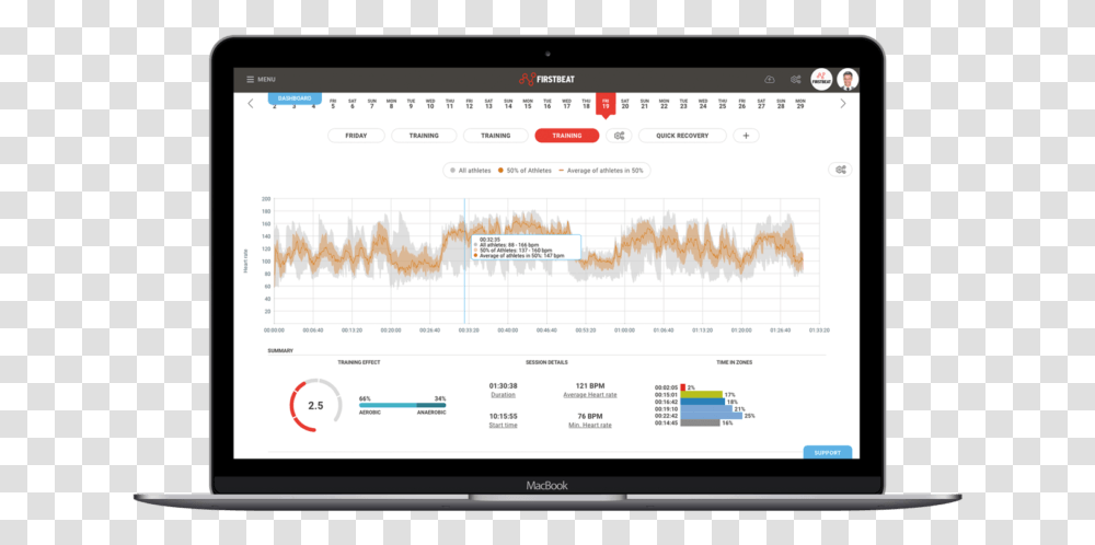 Heart Monitor Line, Computer, Electronics, Tablet Computer, Screen Transparent Png