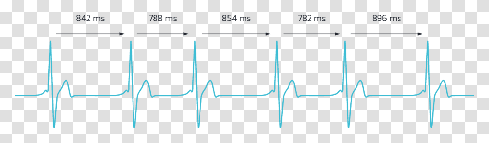 Heartbeat Rate Graph, Plot, Diagram, Outdoors Transparent Png