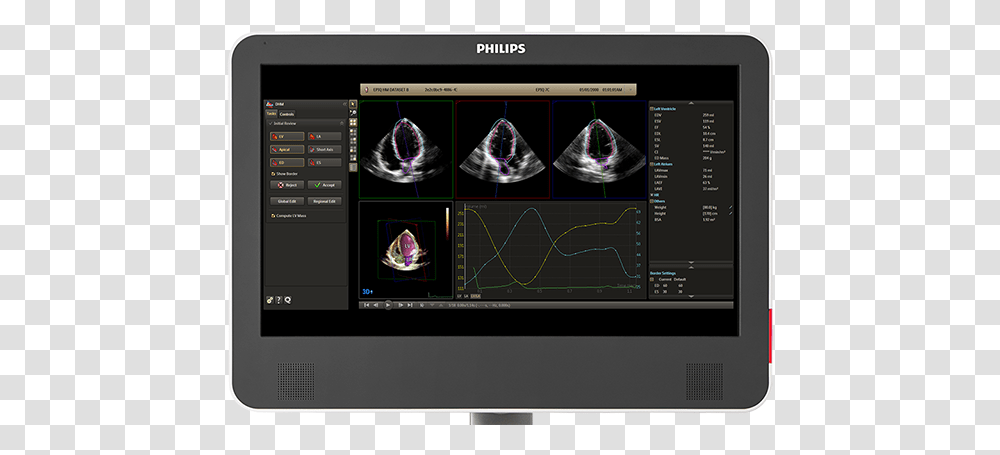 Heartmodel 3d Echocardiography Philips Healthcare Philips Heart Model, Monitor, Screen, Electronics, LCD Screen Transparent Png