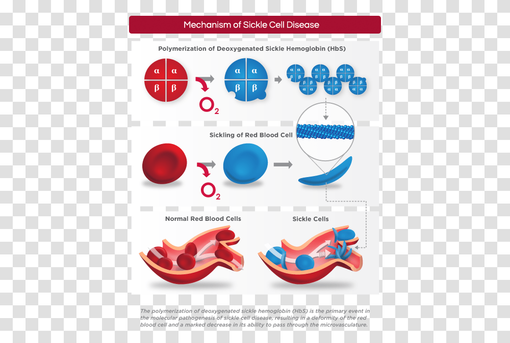 Hemoglobin Polymerization Sickle Cell, Sphere, Diagram, Plot Transparent Png