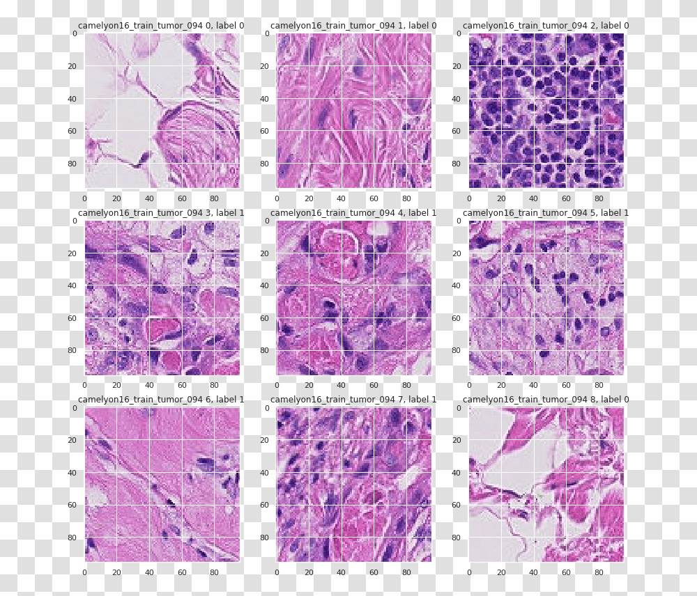 Histopathologic Cancer Detection, Purple, Paper, Pattern, Light Transparent Png