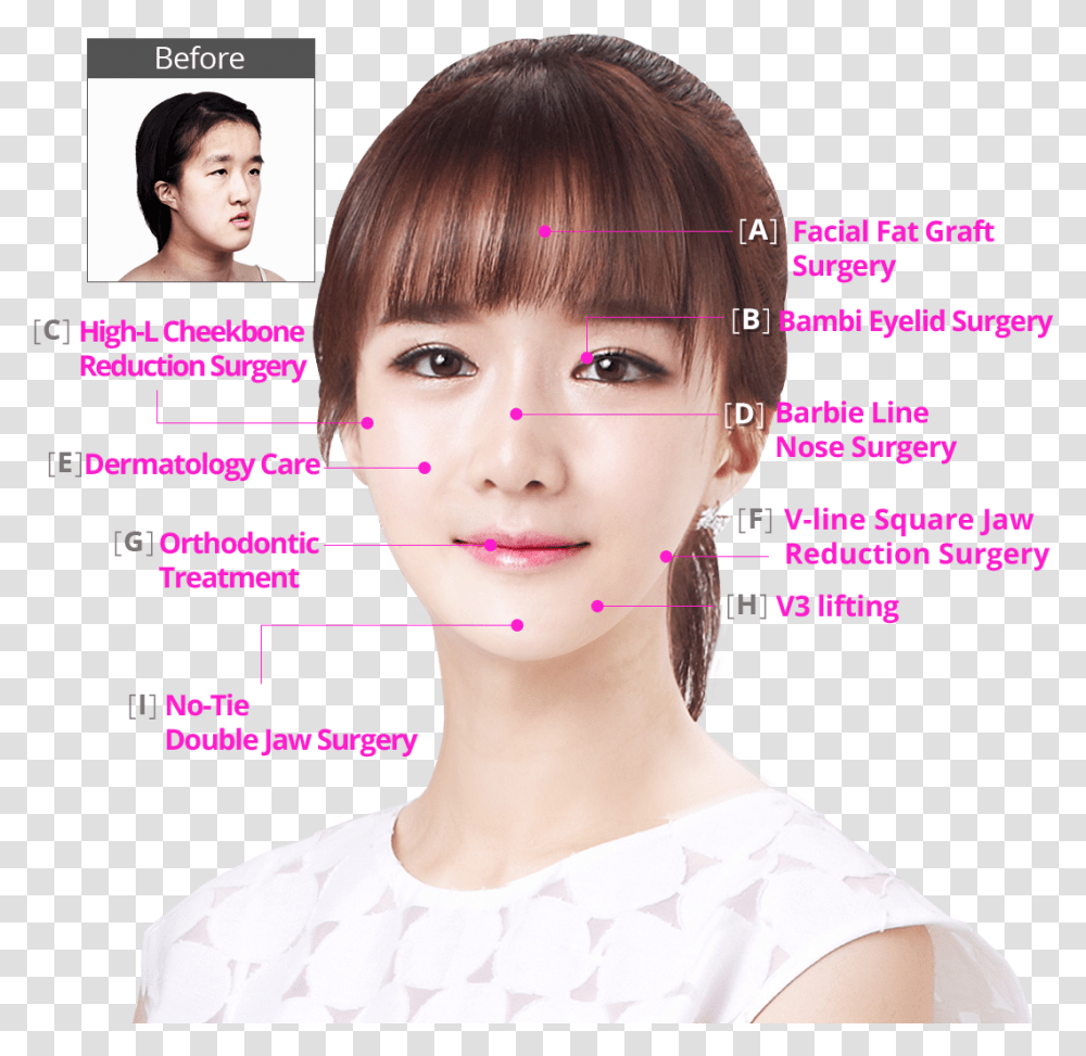 Hospital Perfect Makeover Plan Bambi Eyelid Surgery, Person, Human, Face, Magazine Transparent Png