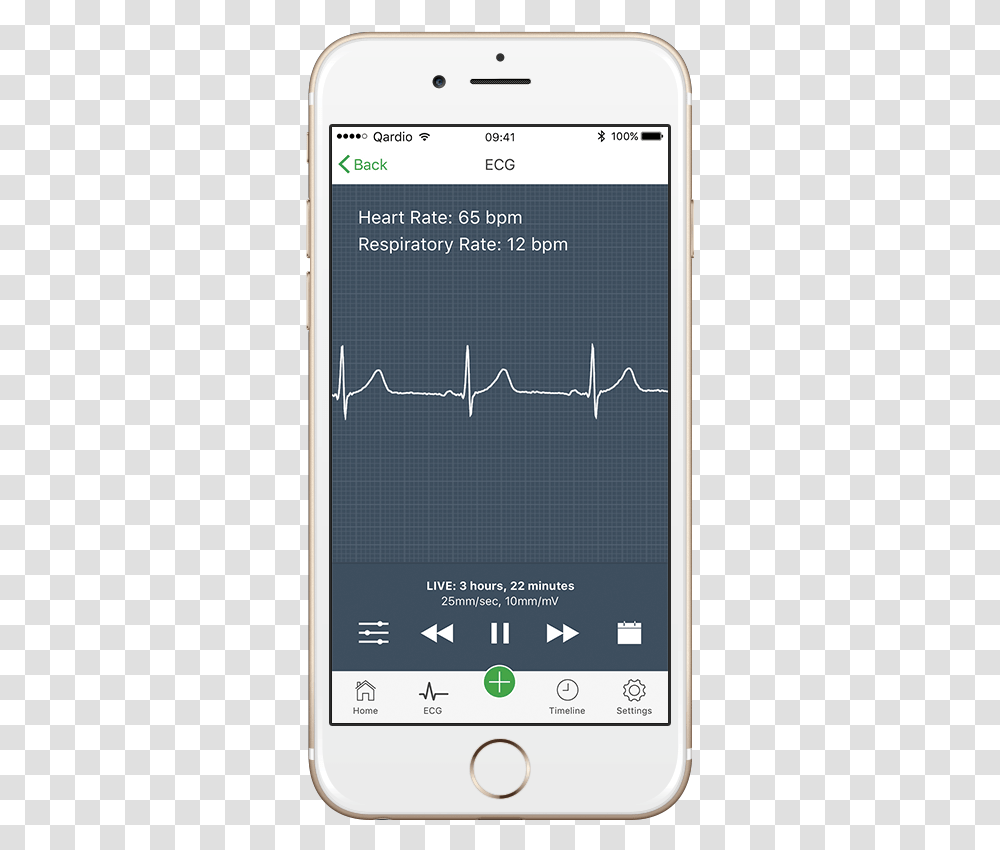 How To Read An Electrocardiogram Atrial Fibrillation Afib Monitor, Mobile Phone, Electronics, Cell Phone Transparent Png