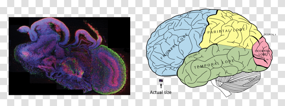 Human Brain Clipart Mini Brains, Plant, Food, Vegetable, Cabbage Transparent Png