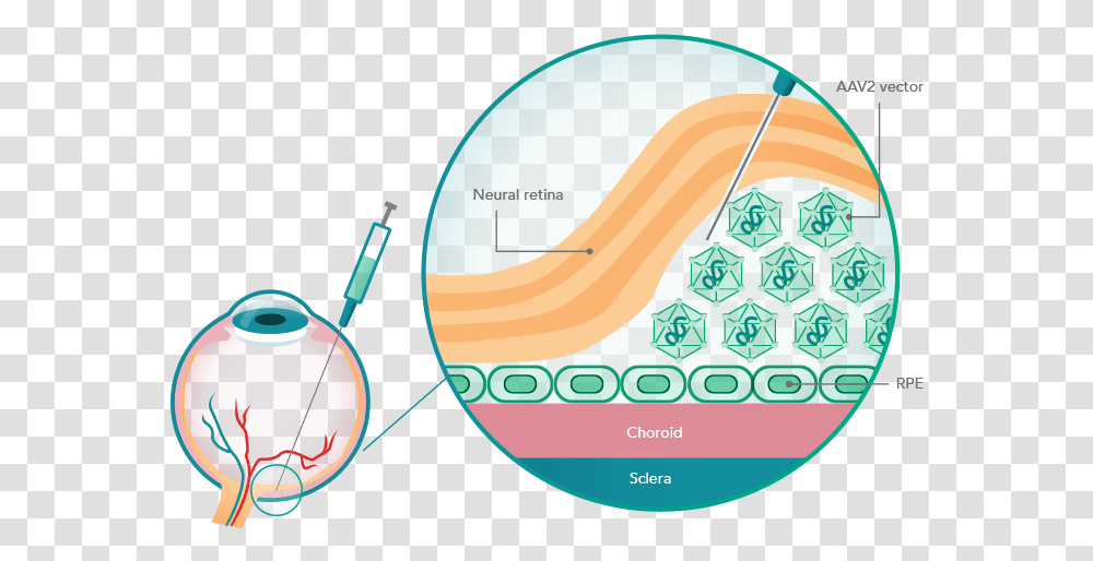 Illustration Of The Rpe65 Gene Delivery Method Luxturna Mechanism Of Action, Outdoors, Nature, Plot, Diagram Transparent Png