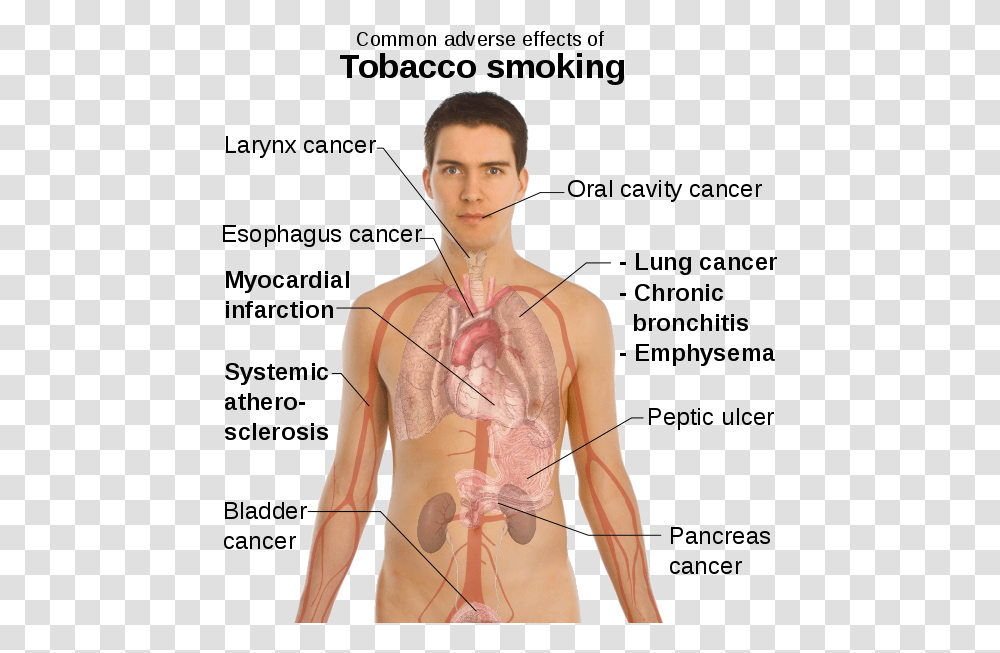 Img Diseases In Circulatory System Caused By Smoking, Person, Human, Plot, Torso Transparent Png